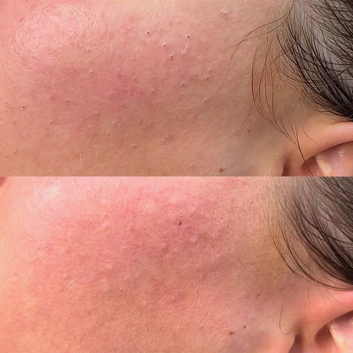 mee-eters voor en na