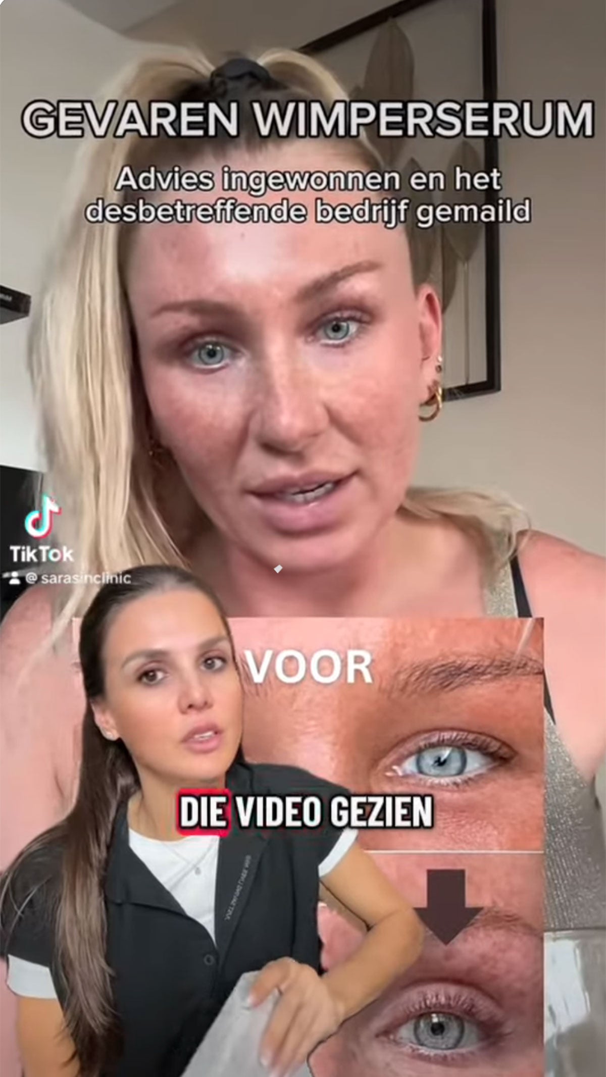 Sarasin short Wimperserum Prostaglandines