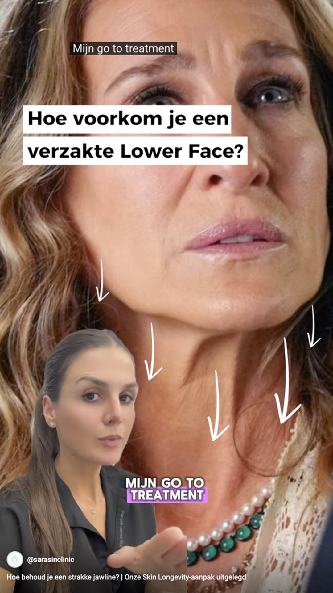 video Hoe behoud je een strakke jawline 