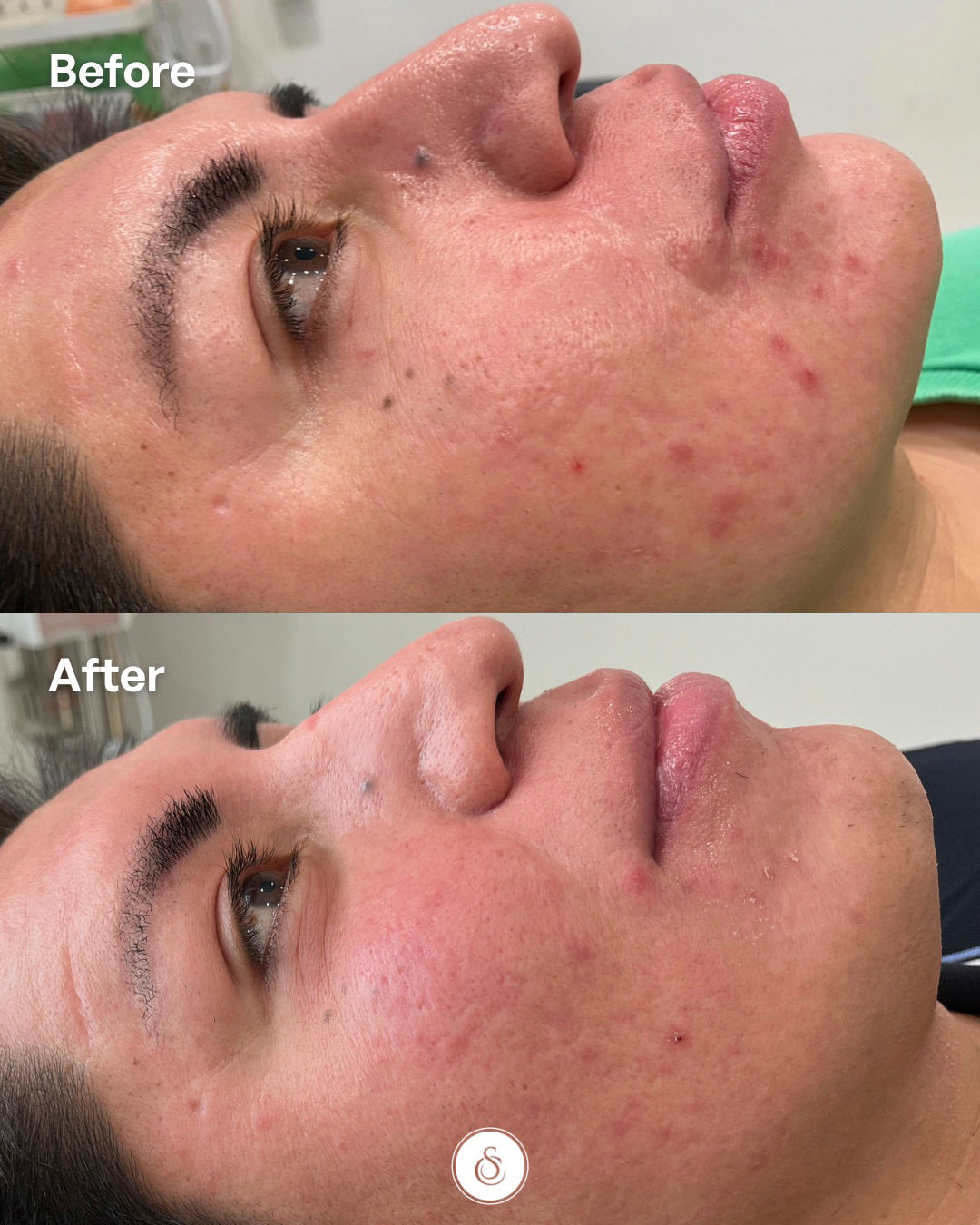 Polynucleotiden behandeling voor en na