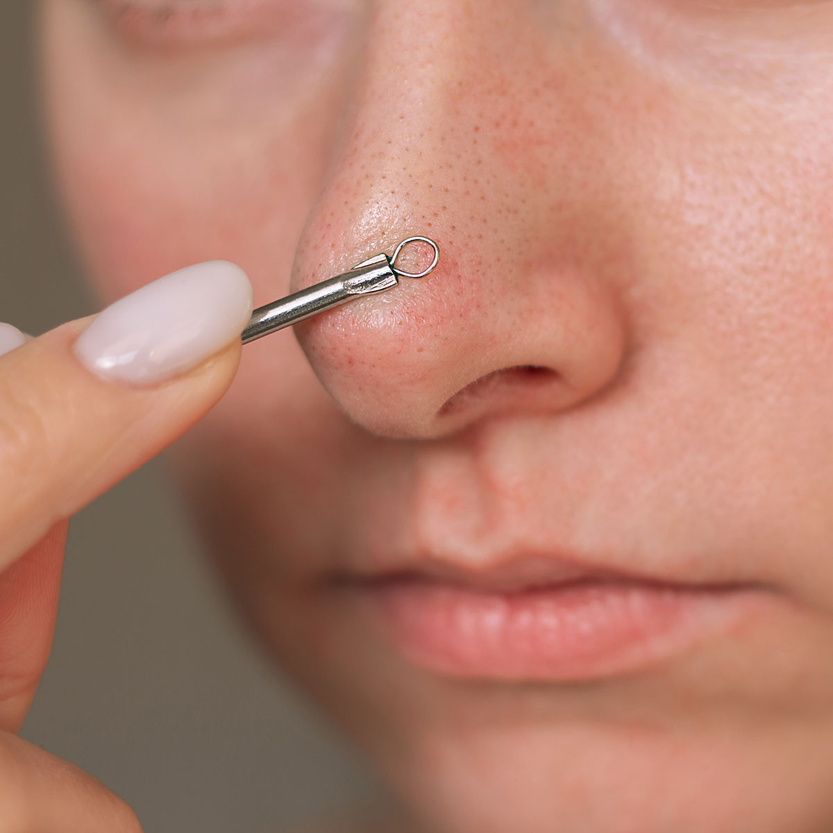 blackhead remover