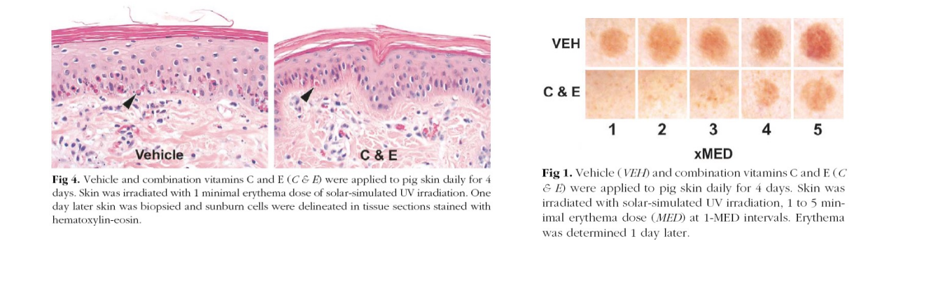 Histologische vergelijking van huid na vitamine C en E toepassing